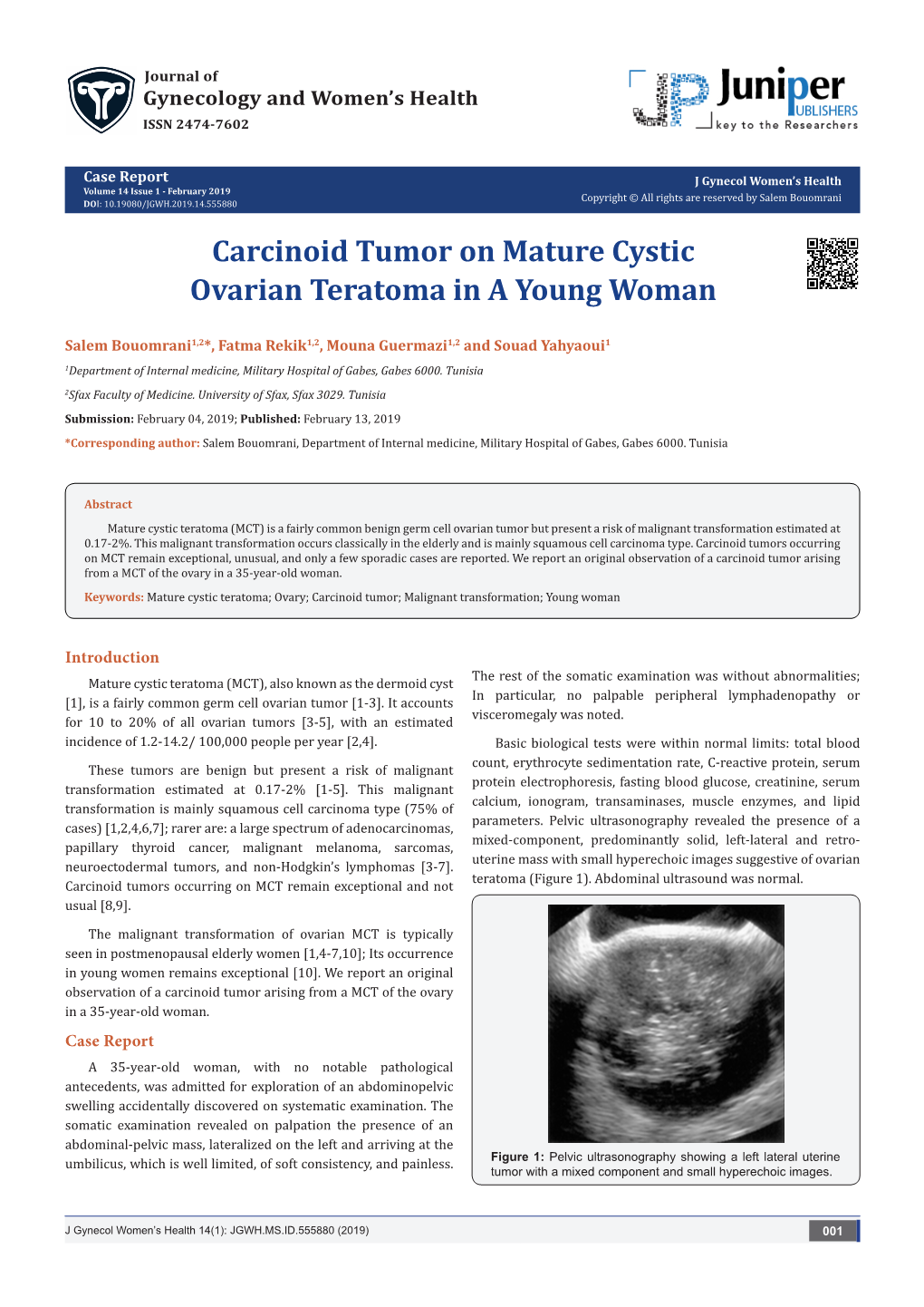 Carcinoid Tumor on Mature Cystic Ovarian Teratoma in a Young Woman