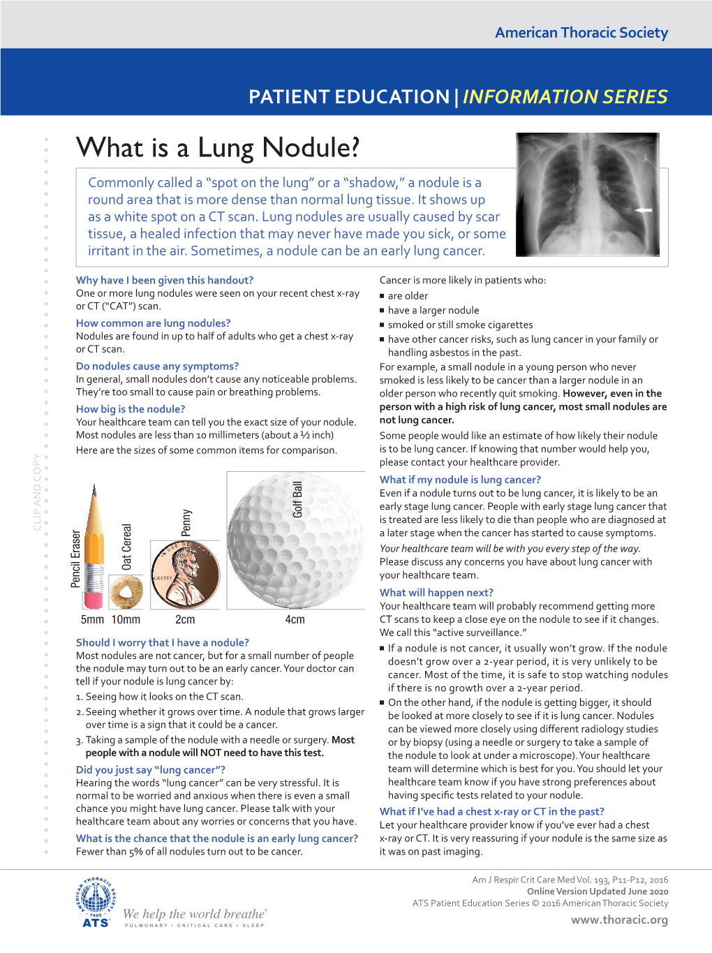 What Is a Lung Nodule? Commonly Called a “Spot on the Lung” Or a “Shadow,” a Nodule Is a Round Area That Is More Dense Than Normal Lung Tissue