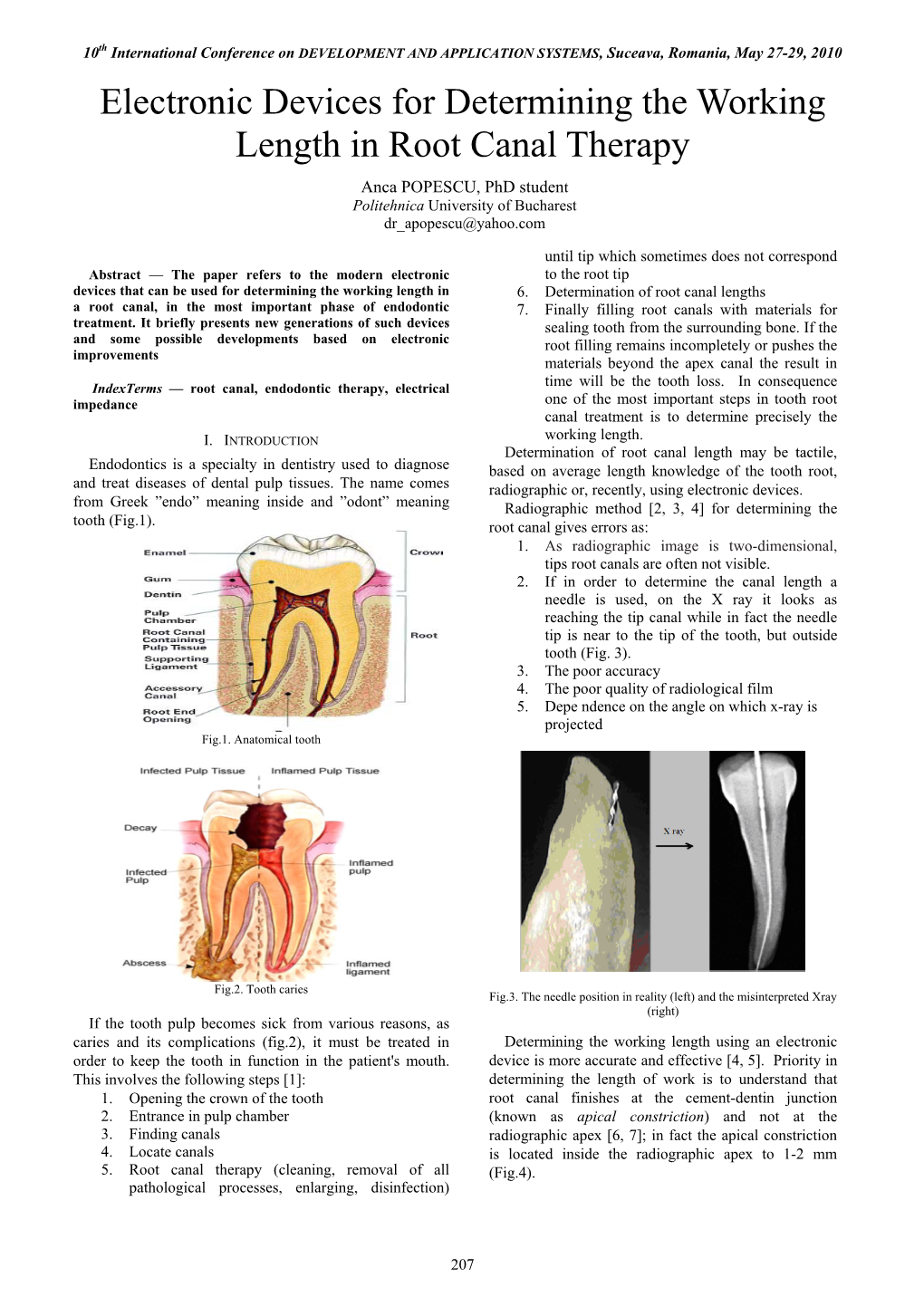 Electronic Devices for Determining the Working Length in Root Canal Therapy Anca POPESCU, Phd Student Politehnica University of Bucharest Dr Apopescu@Yahoo.Com