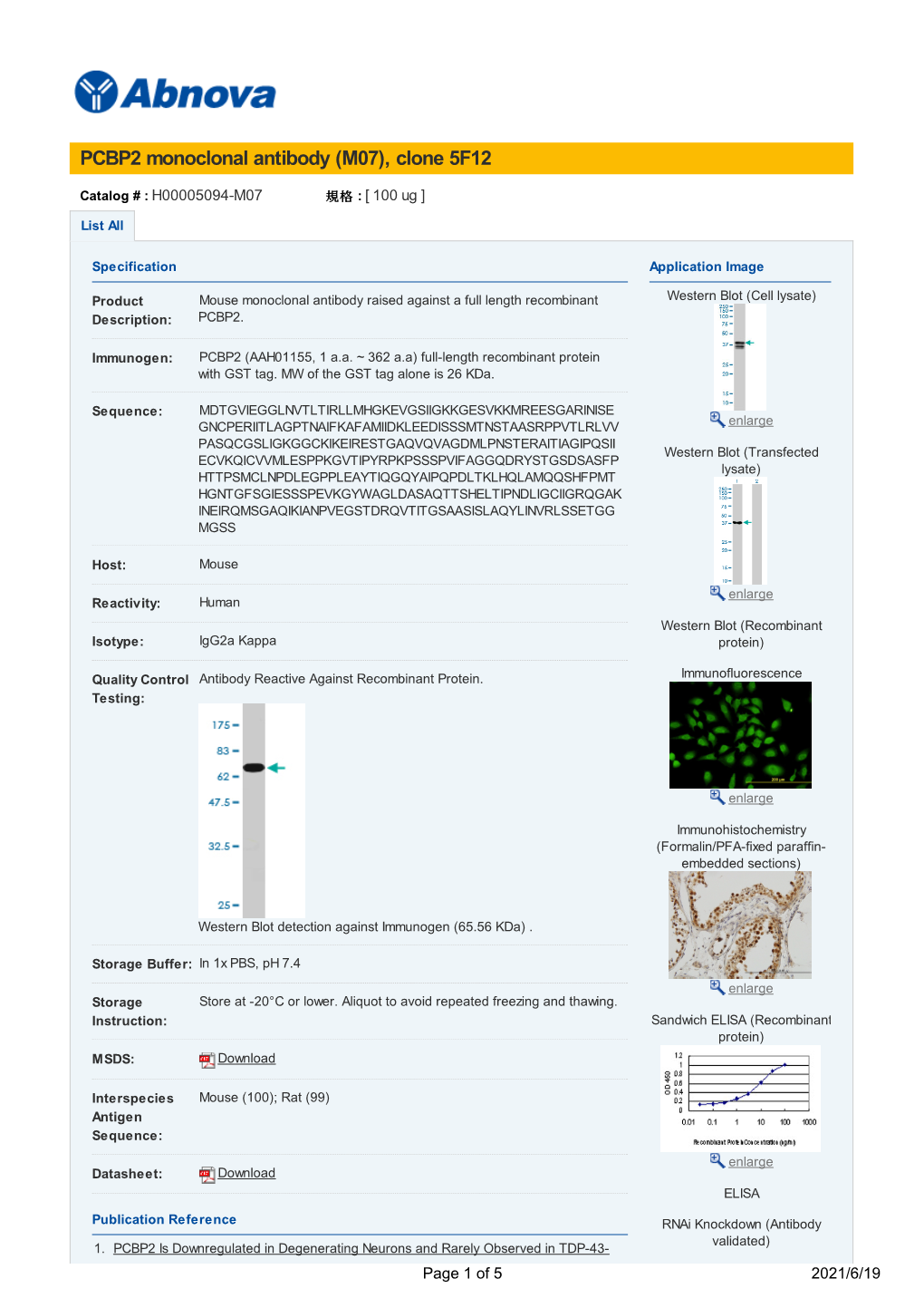 PCBP2 Monoclonal Antibody (M07), Clone 5F12