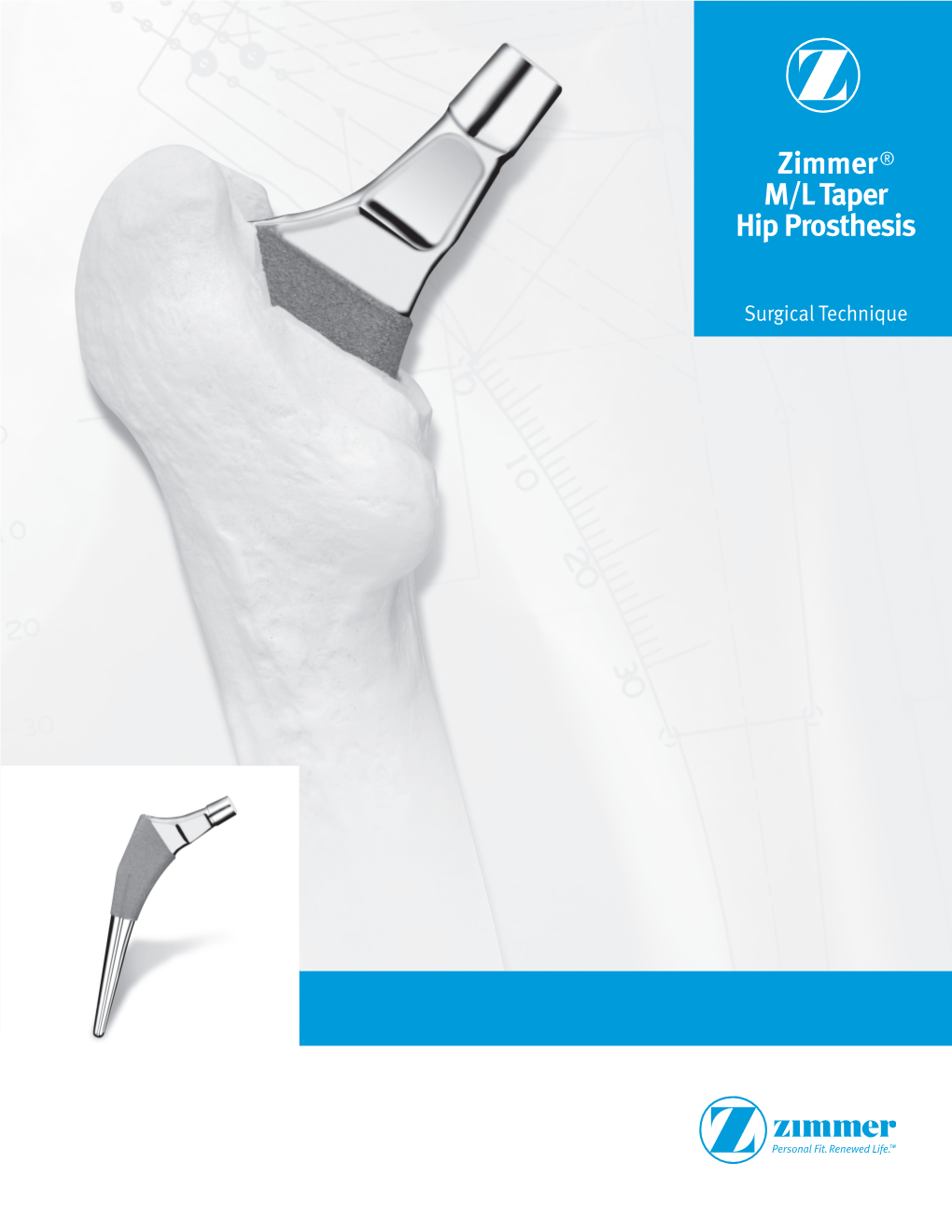 Zimmer® M/L Taper Hip Prosthesis Surgical Technique