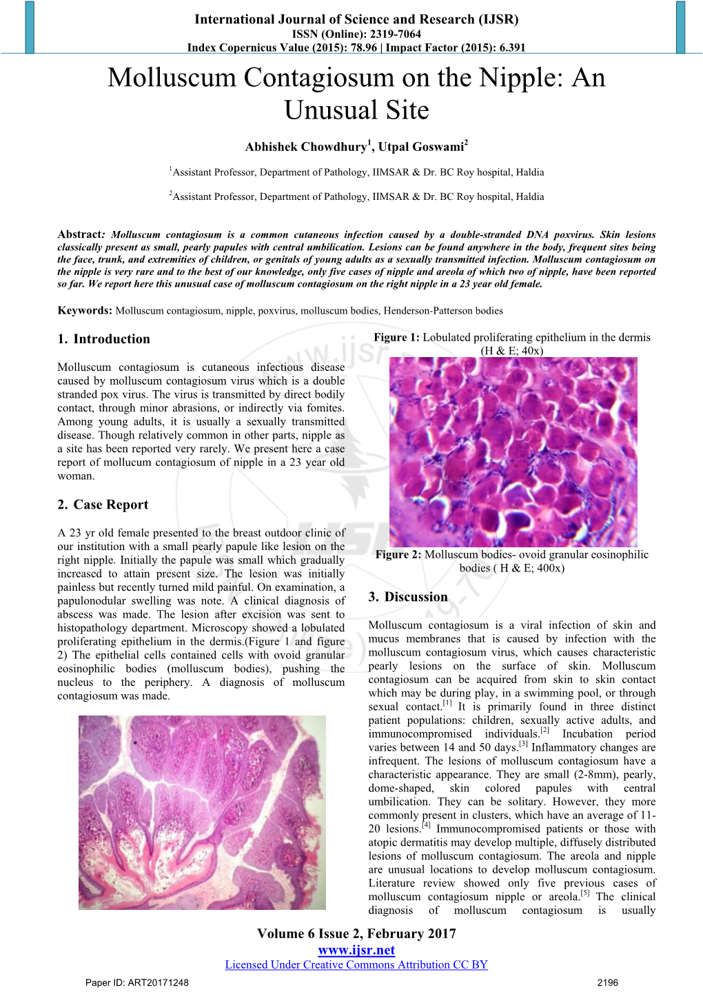 Molluscum Contagiosum on the Nipple: an Unusual Site