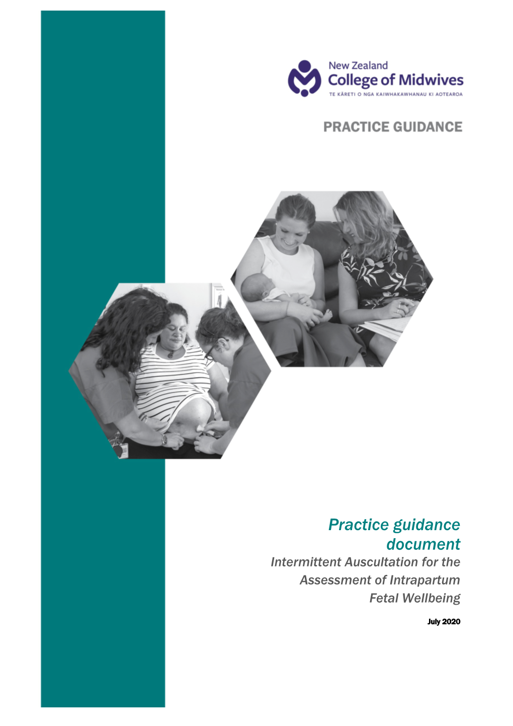 Practice Guidance Document Intermittent Auscultation for the Assessment of Intrapartum Fetal Wellbeing