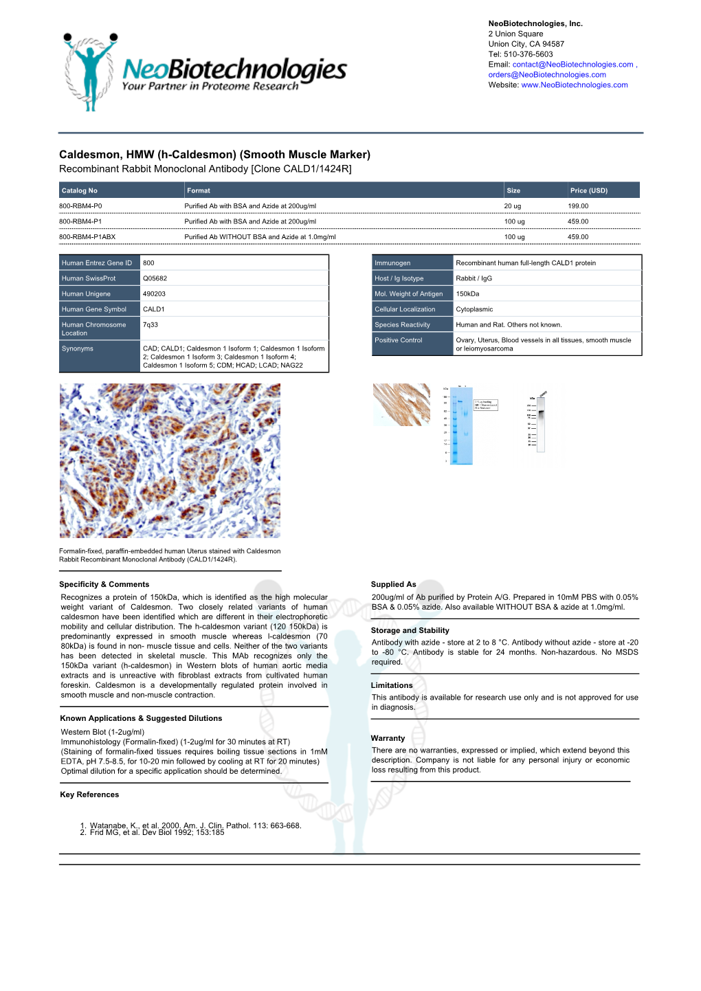 H-Caldesmon) (Smooth Muscle Marker) Recombinant Rabbit Monoclonal Antibody [Clone CALD1/1424R]