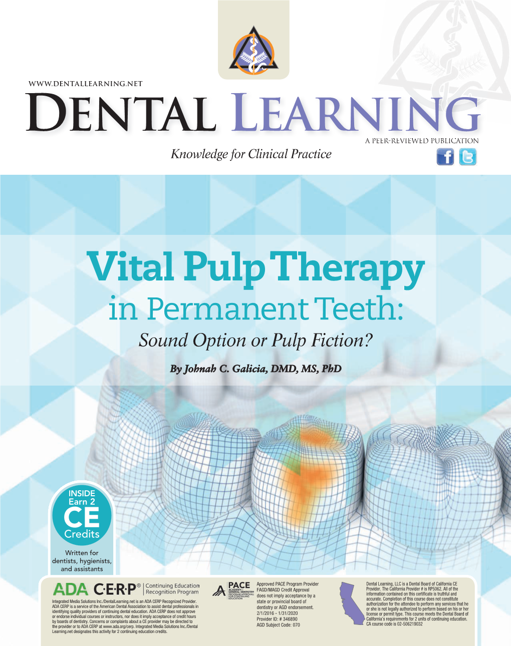 Pulp Therapy Aspects of Vital Pulp Therapy (VPT) in Permanent Teeth 3