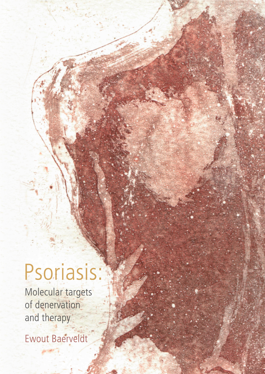 Psoriasis: Molecular Targets of Denervation and Therapy