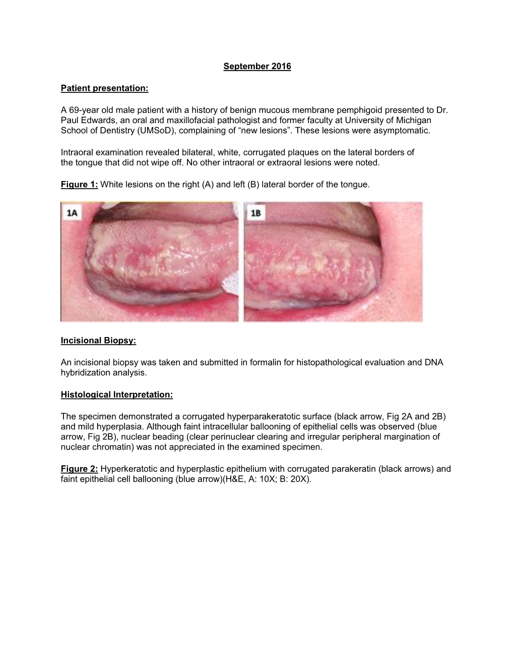 A 69-Year Old Male Patient with a History of Benign Mucous Membrane Pemphigoid Presented to Dr