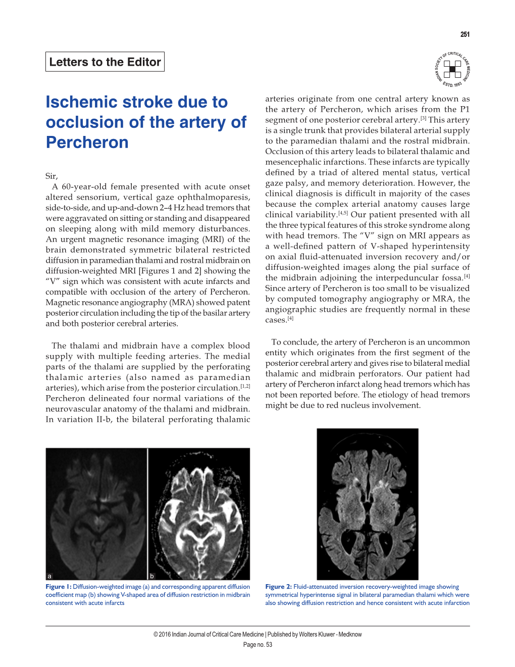 Ischemic Stroke Due to Occlusion of the Artery of Percheron