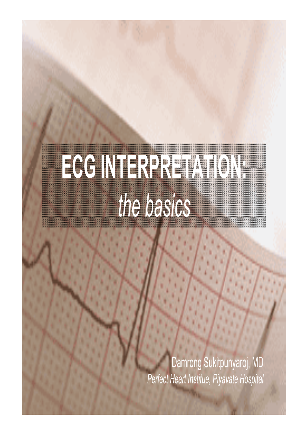 ECG INTERPRETATION: ECG INTERPRETATION: the Basics