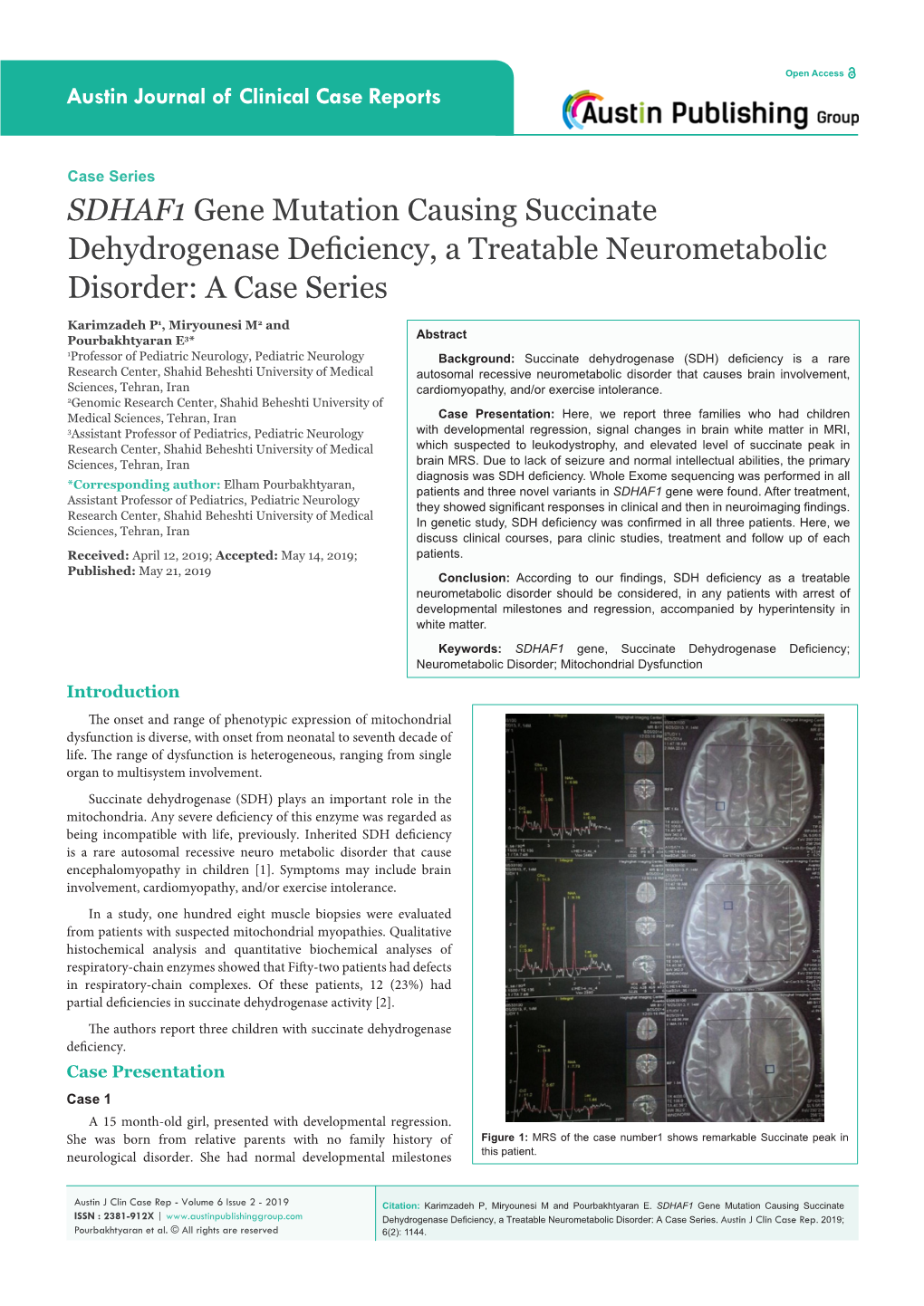 SDHAF1 Gene Mutation Causing Succinate Dehydrogenase Deficiency, a Treatable Neurometabolic Disorder: a Case Series