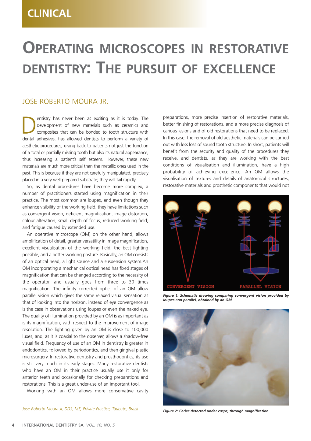Operating Microscopes in Restorative Dentistry : T He Pursuit of Excellence