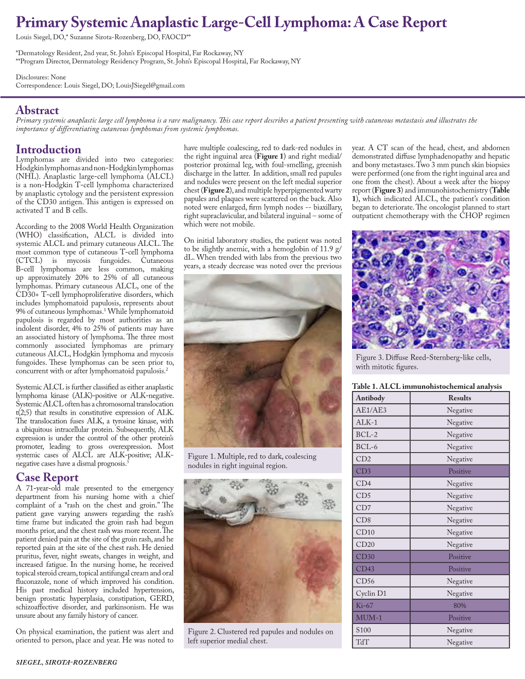 Primary Systemic Anaplastic Large-Cell Lymphoma: a Case Report Louis Siegel, DO,* Suzanne Sirota-Rozenberg, DO, FAOCD**