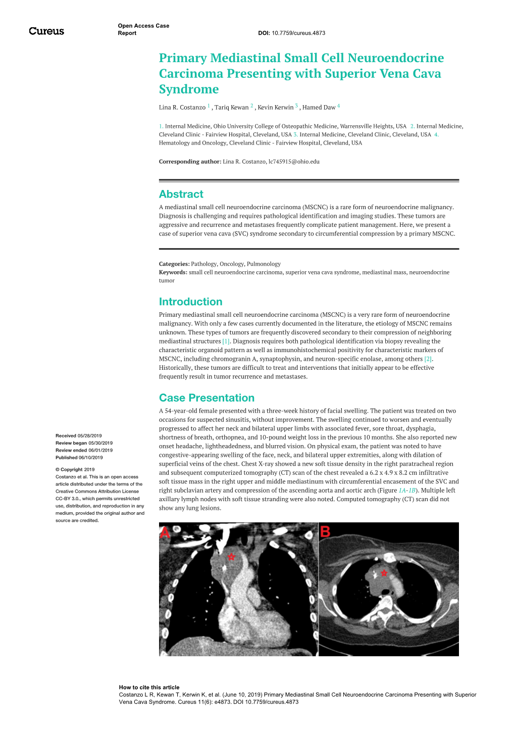 Primary Mediastinal Small Cell Neuroendocrine Carcinoma Presenting with Superior Vena Cava Syndrome