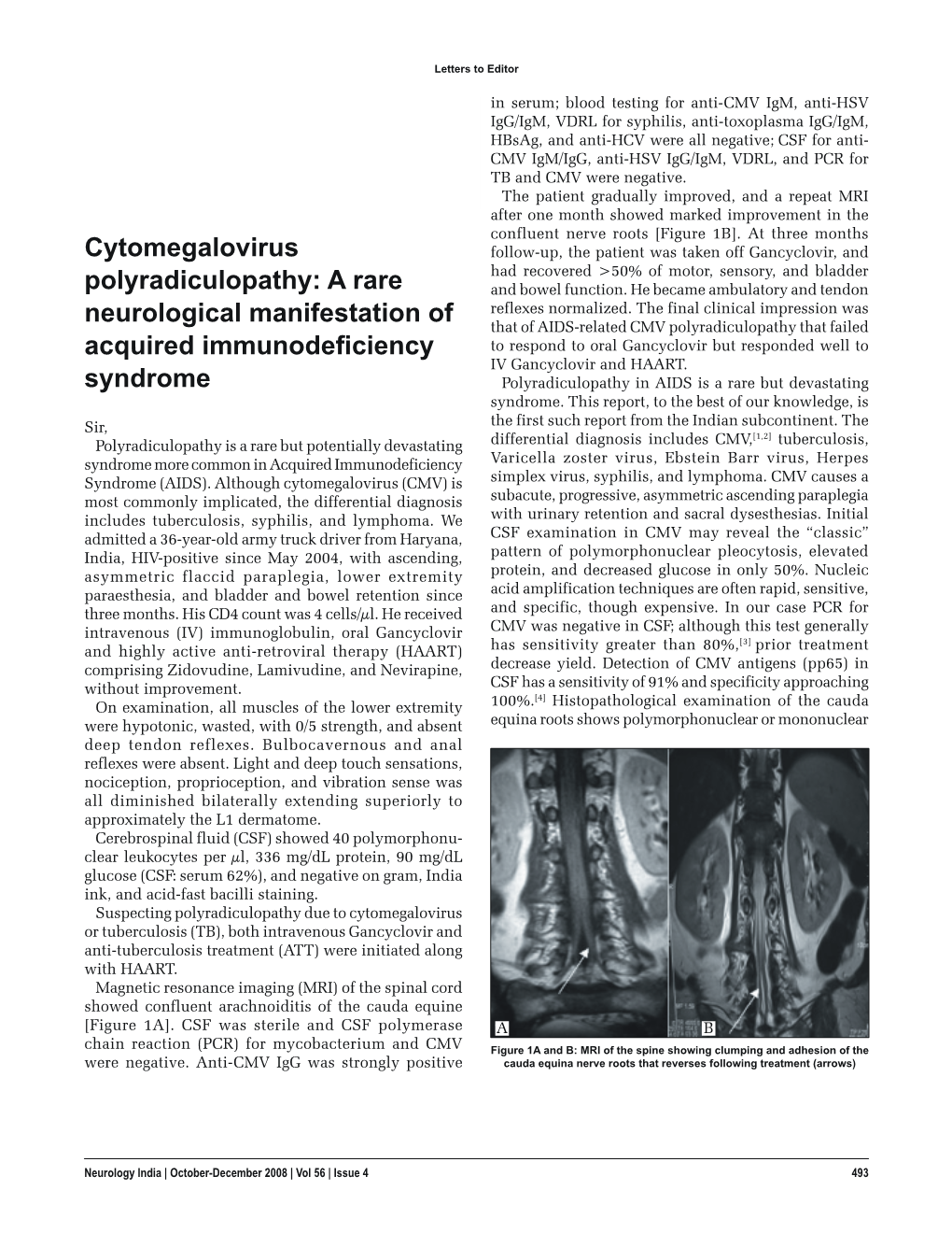 Cytomegalovirus Polyradiculopathy