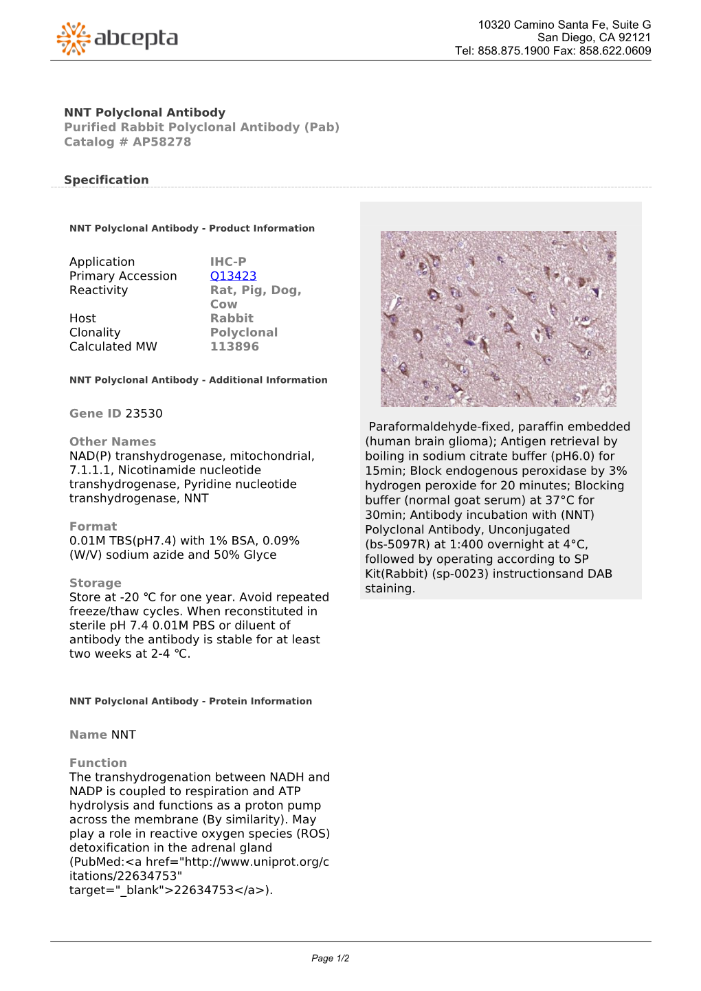 NNT Polyclonal Antibody Purified Rabbit Polyclonal Antibody (Pab) Catalog # AP58278