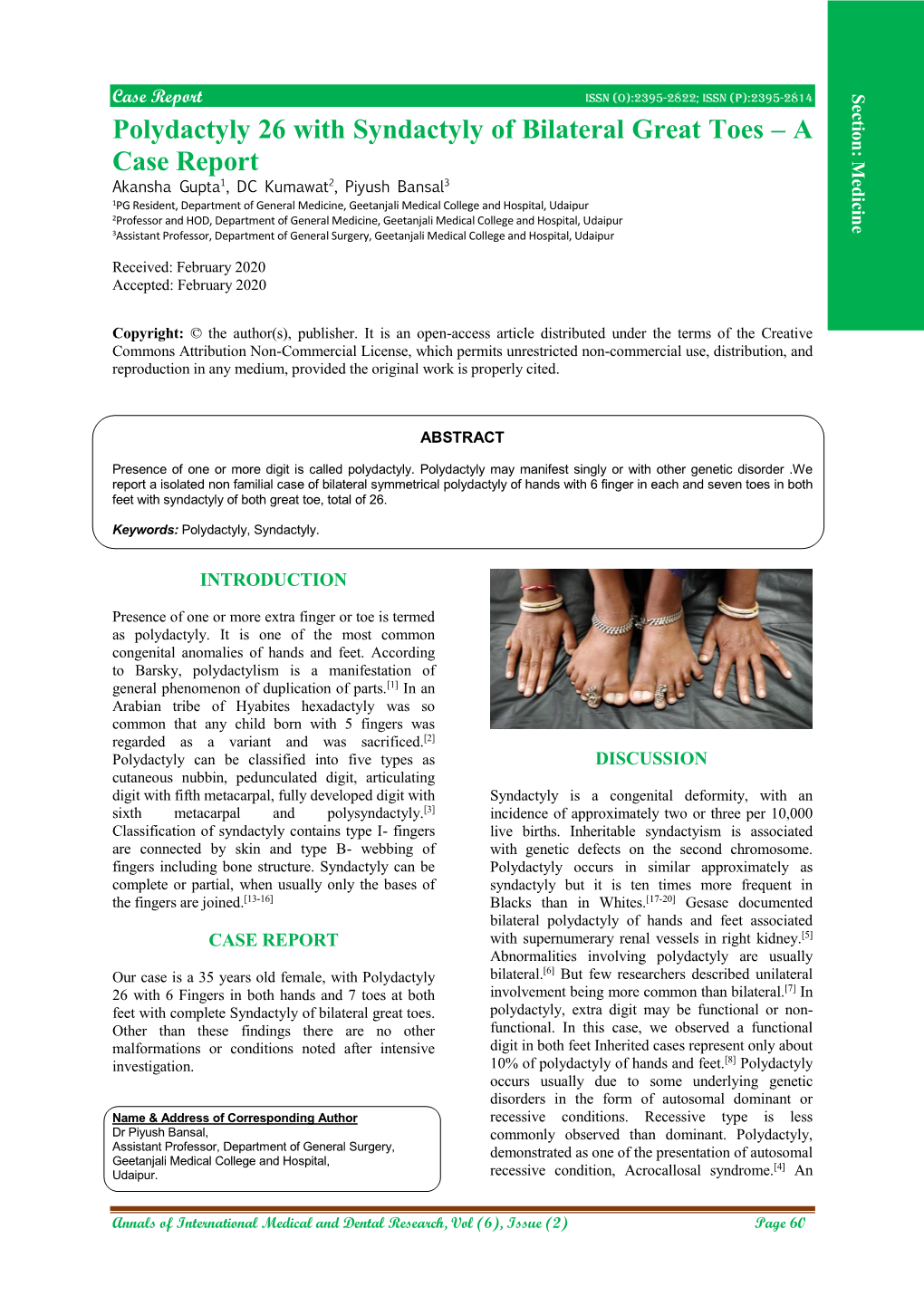 Polydactyly 26 with Syndactyly of Bilateral Great Toes