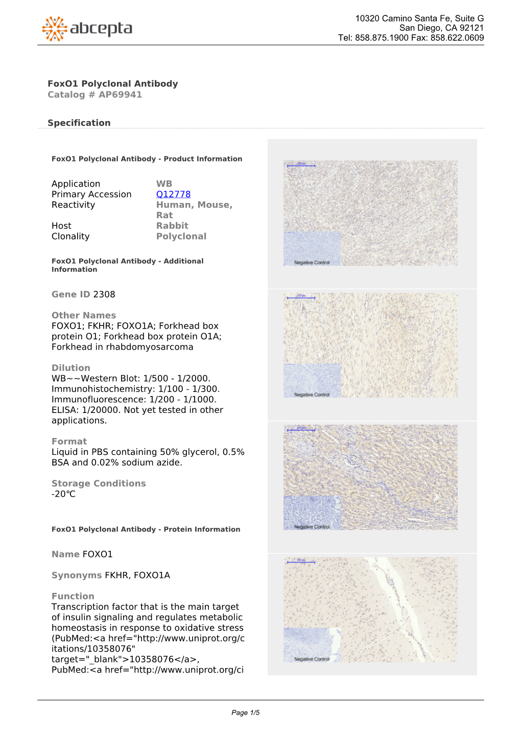 Foxo1 Polyclonal Antibody Catalog # AP69941