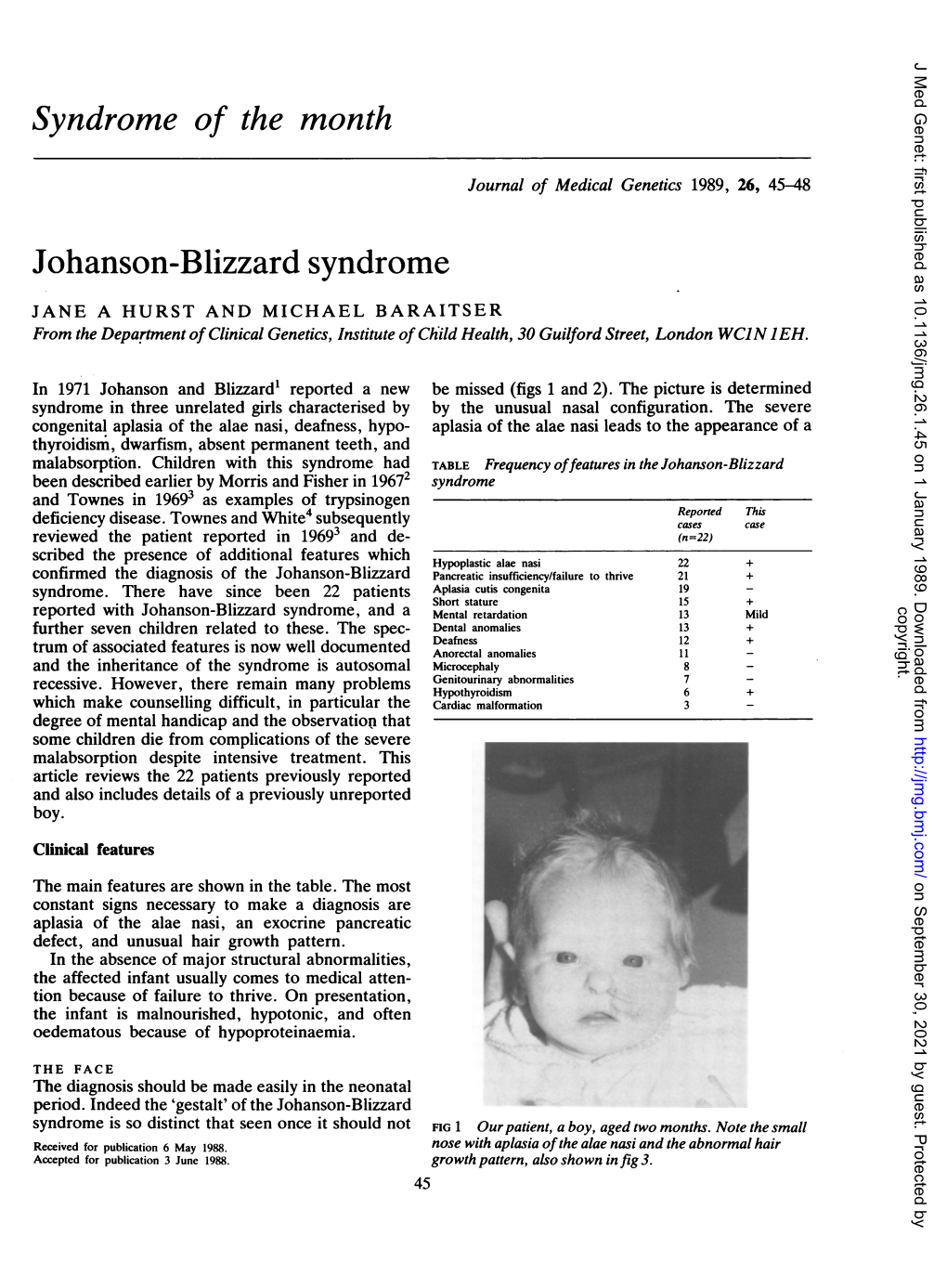 Syndrome of the Month Johanson-Blizzard Syndrome