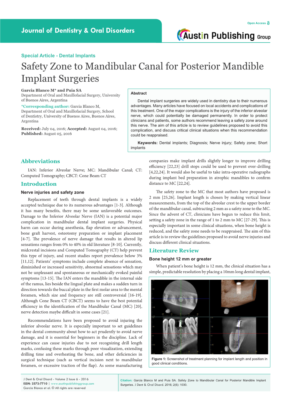 Safety Zone to Mandibular Canal for Posterior Mandible Implant Surgeries