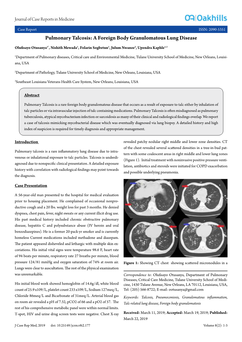 Pulmonary Talcosis: a Foreign Body Granulomatous Lung Disease