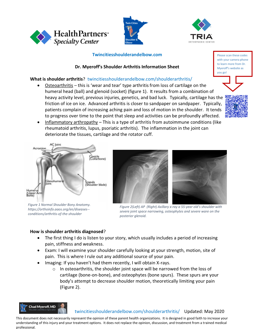 Shoulder Arthritis