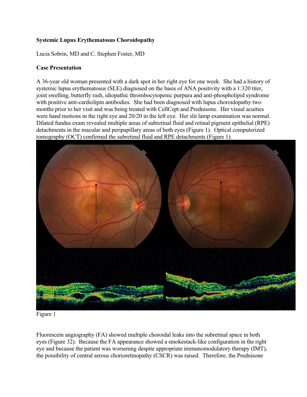 “Systemic Lupus Erythematosus Choroidopathy”