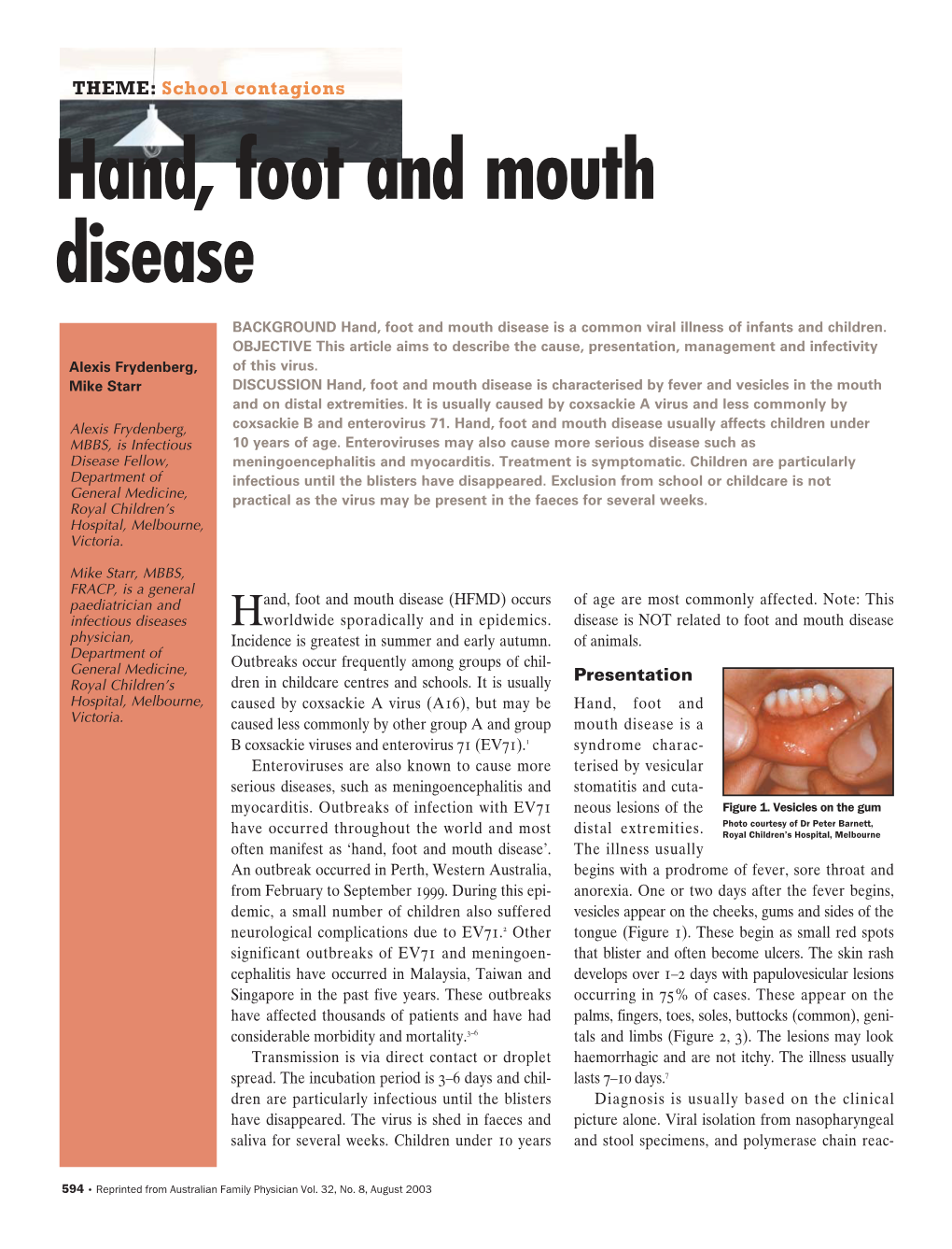 Hand, Foot and Mouth Disease