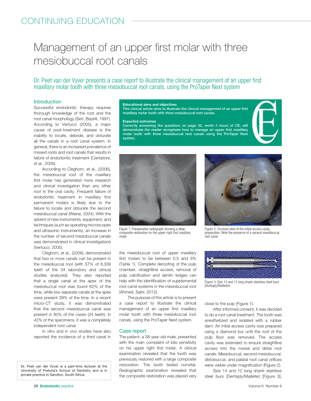 Management of an Upper First Molar with Three Mesiobuccal Root Canals