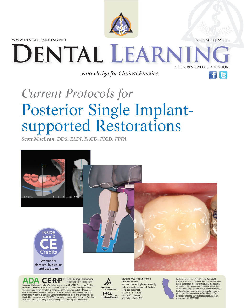 Current Protocols for Posterior Single Implant-Supported Restorations