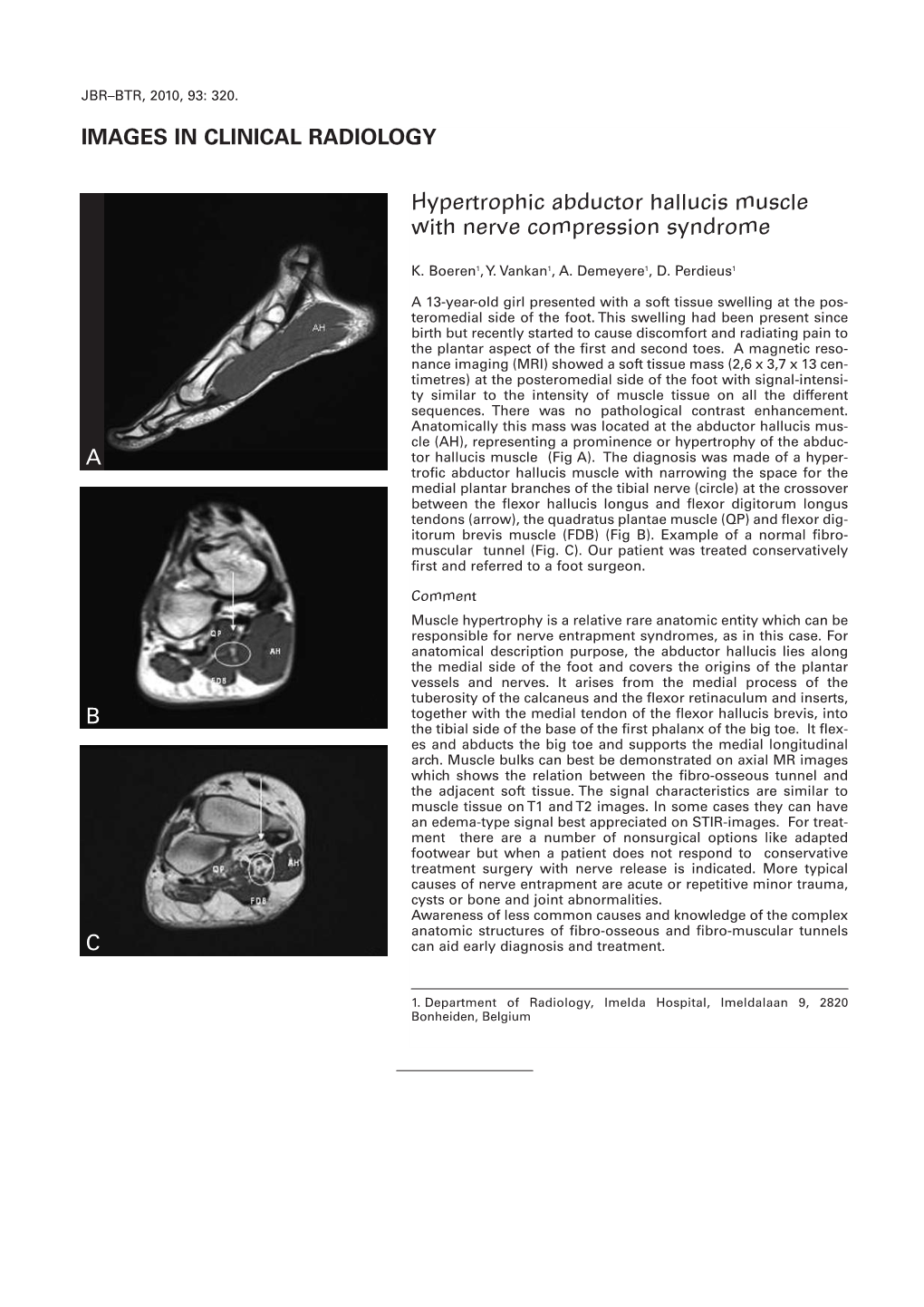 IMAGES in CLINICAL RADIOLOGY Hypertrophic Abductor Hallucis