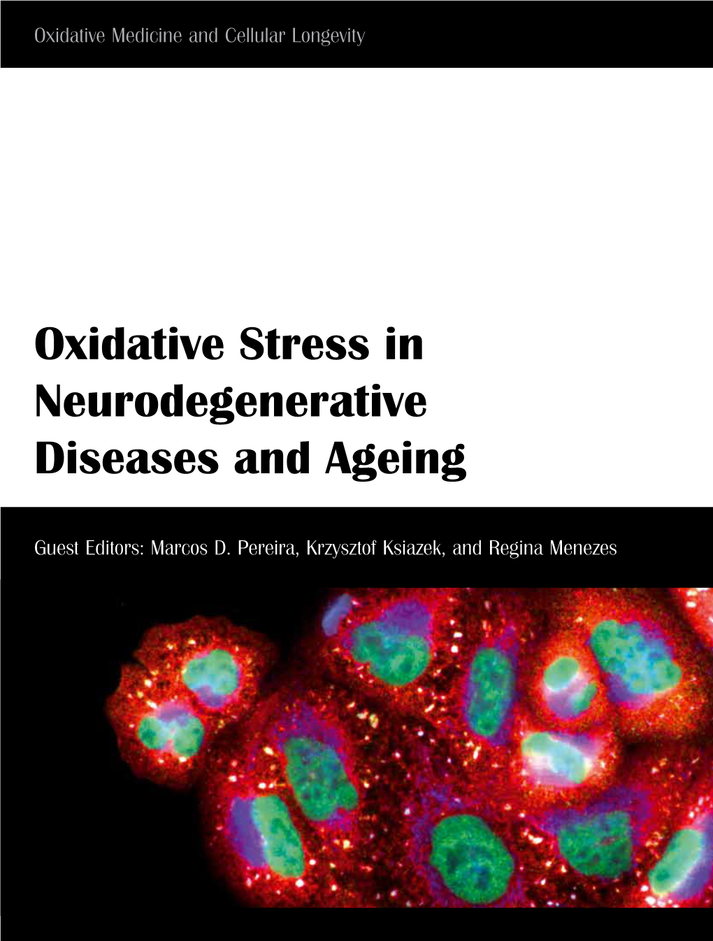 Oxidative Stress in Neurodegenerative Diseases and Ageing