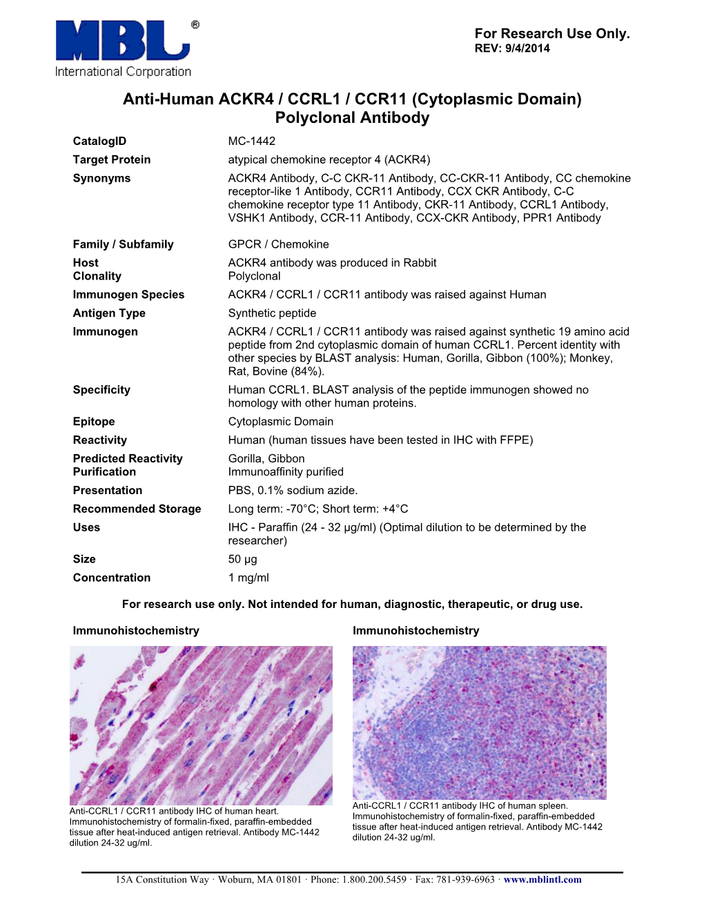 Anti-Human ACKR4 / CCRL1 / CCR11 (Cytoplasmic Domain) Polyclonal Antibody