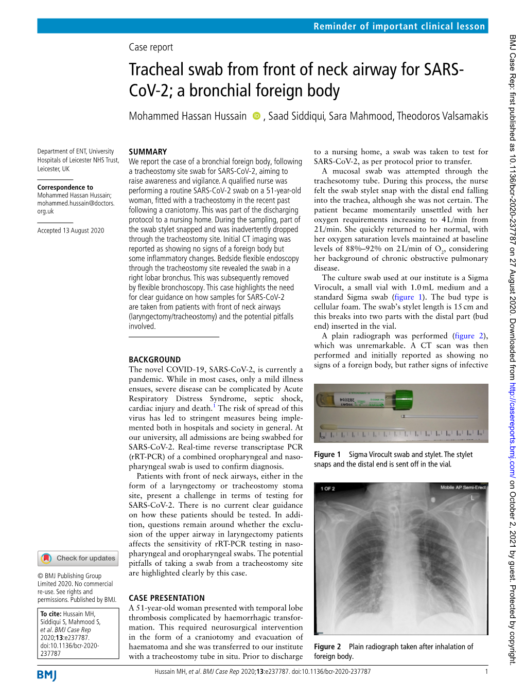 Tracheal Swab from Front of Neck Airway for SARS-Cov-2