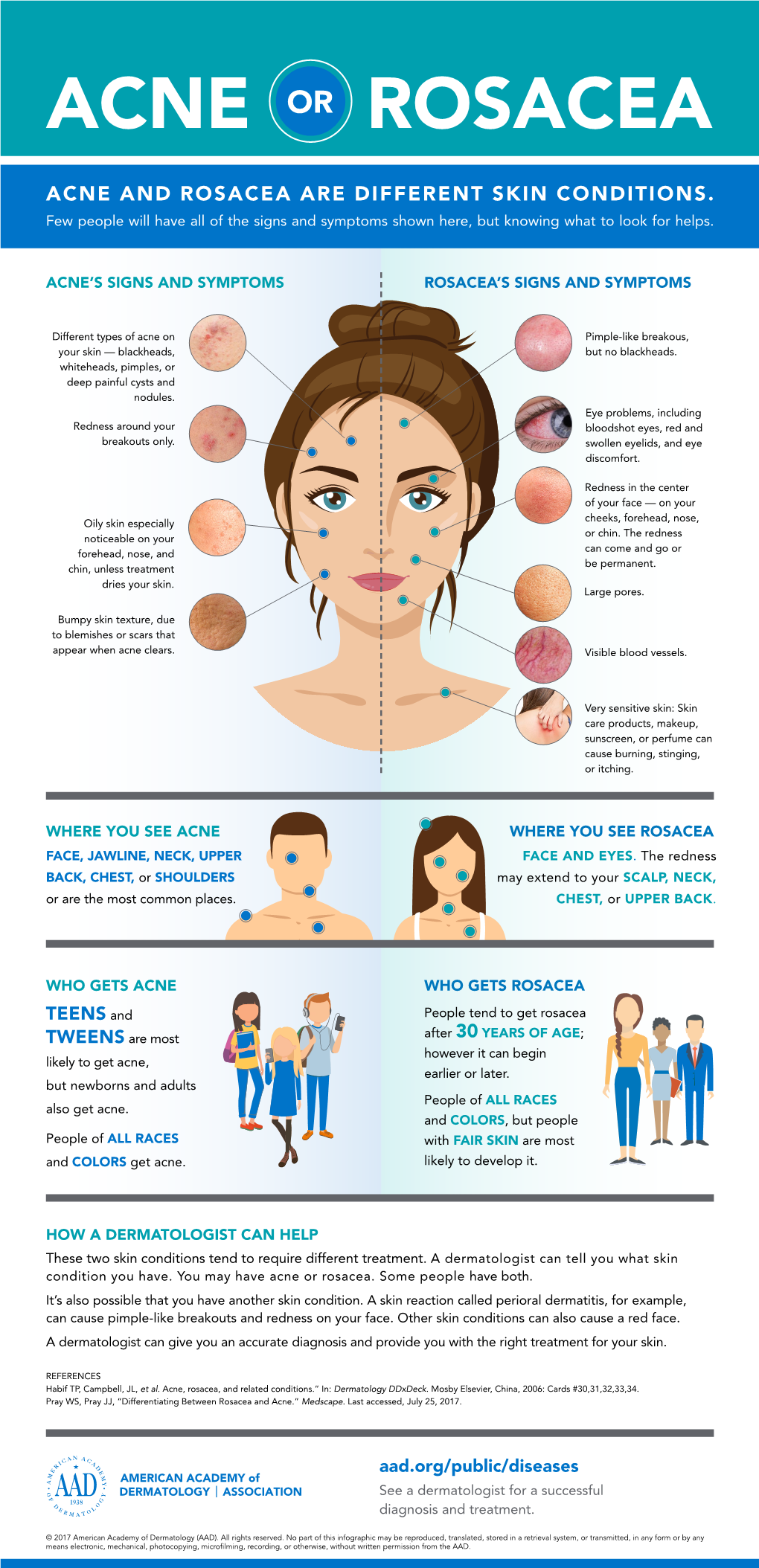 Acne Rosacea