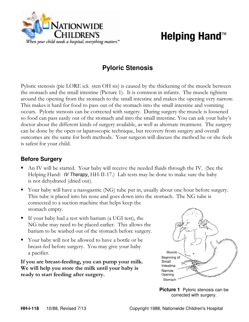 Pyloric Stenosis