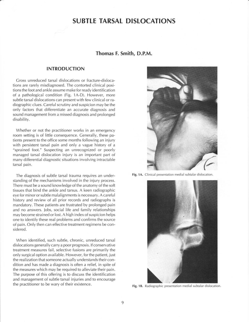 Subtte Tarsal Dislocations