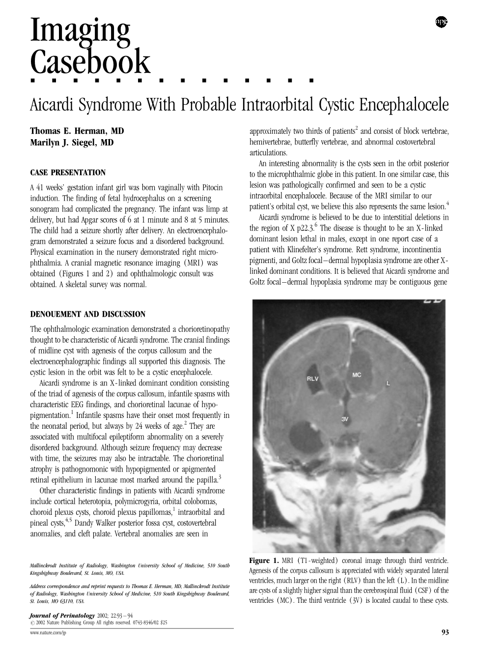 Imaging Casebook &&&&&&&&&&&&&& Aicardi Syndrome with Probable Intraorbital Cystic Encephalocele