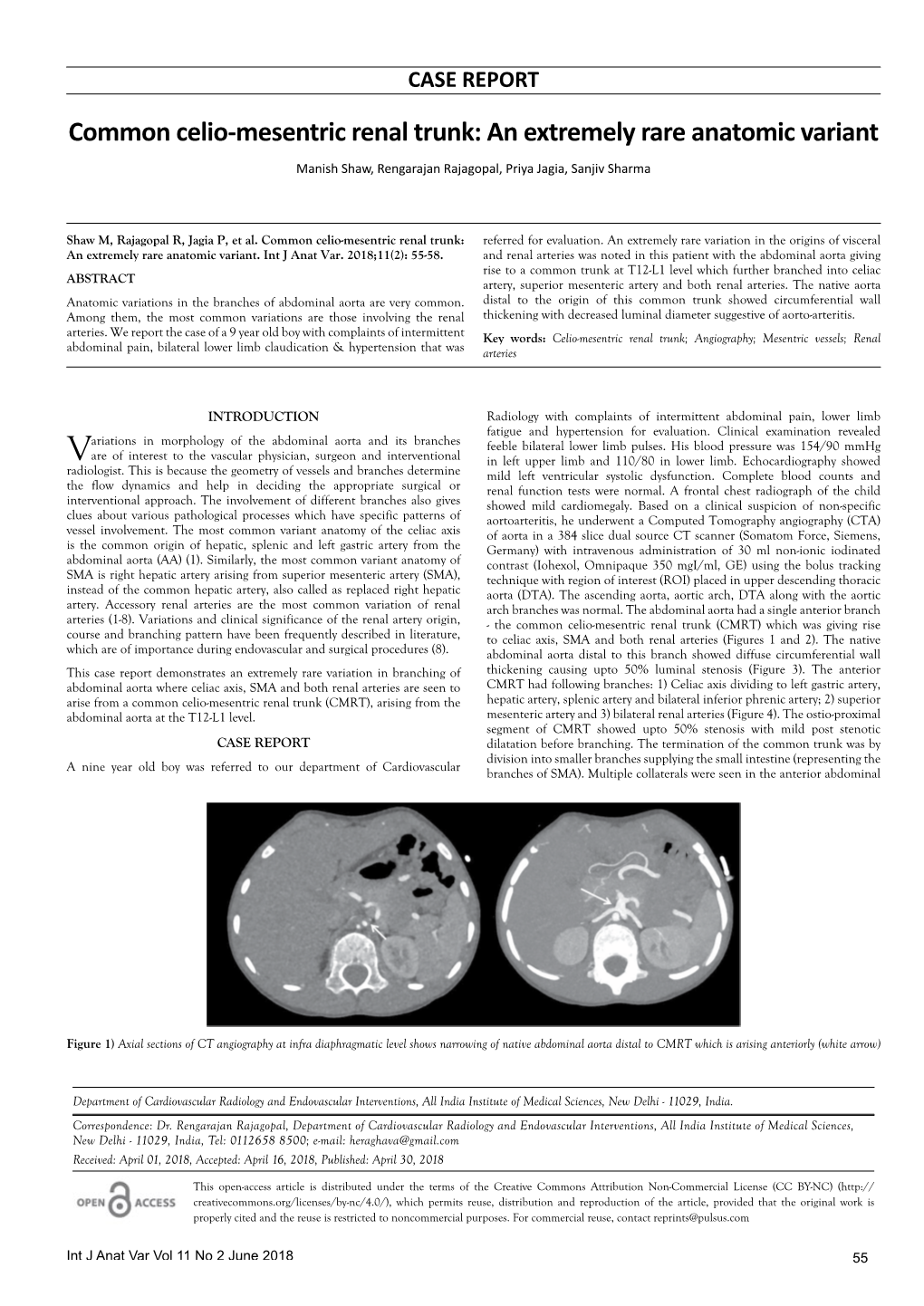 Common Celio-Mesentric Renal Trunk: an Extremely Rare Anatomic Variant