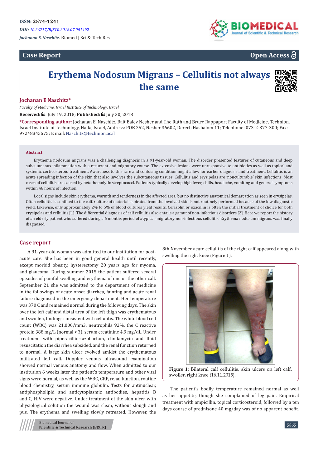 Erythema Nodosum Migrans