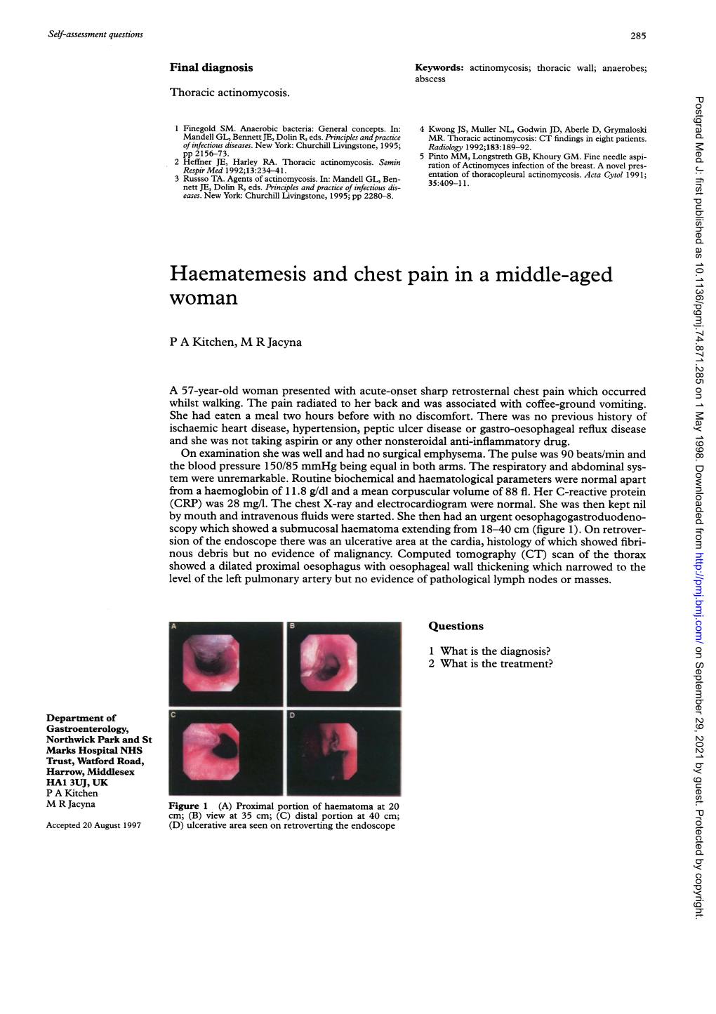 Haematemesis and Chest Pain in a Middle-Aged Woman