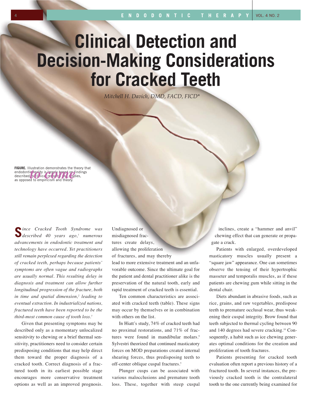 Clinical Detection and Decision-Making Considerations for Cracked Teeth Mitchell H