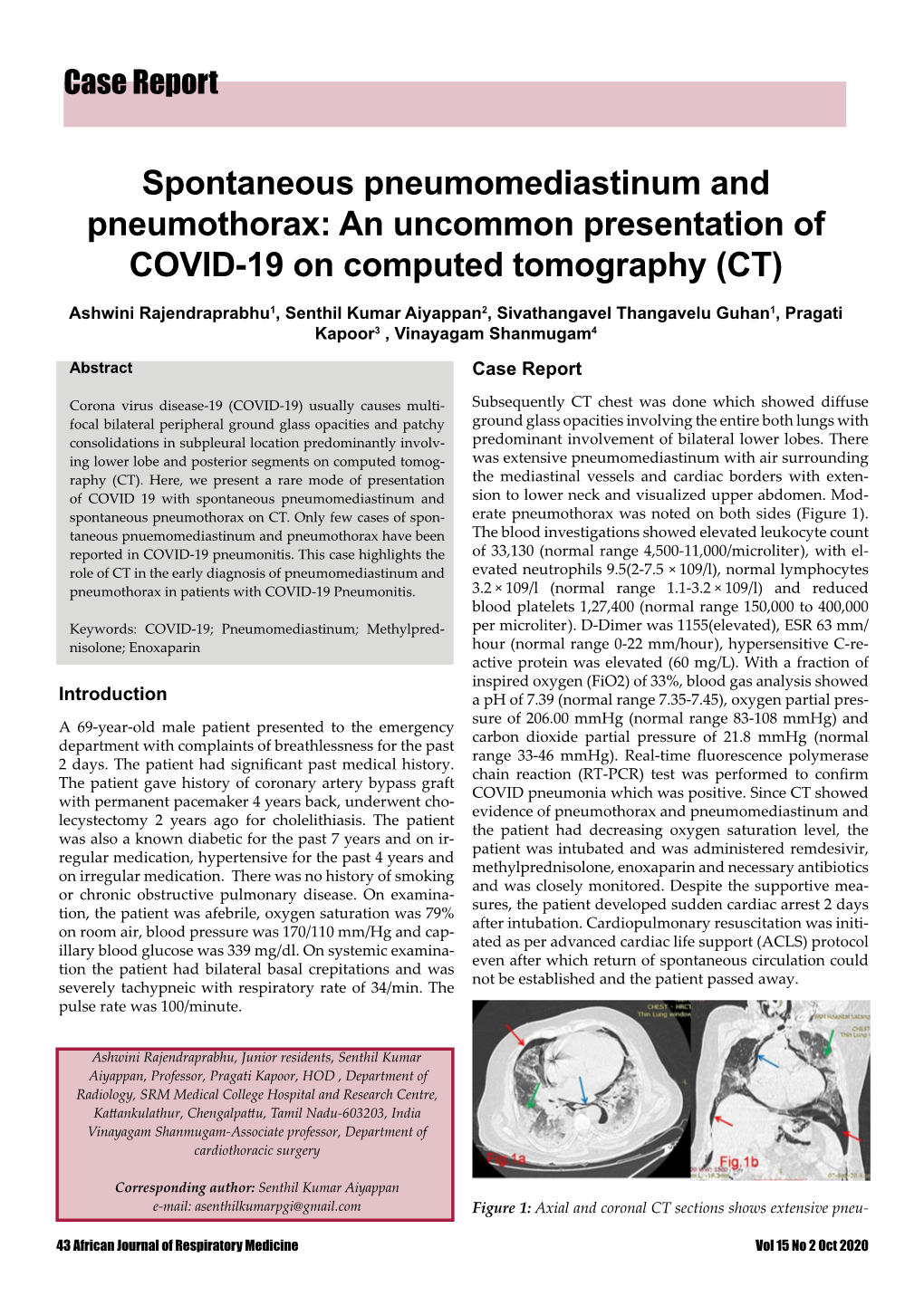 Spontaneous Pneumomediastinum and Pneumothorax: an Uncommon Presentation of COVID-19 on Computed Tomography (CT)