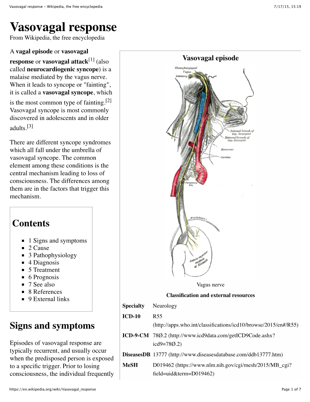 Vasovagal Response - Wikipedia, the Free Encyclopedia 7/17/15, 15:19 Vasovagal Response from Wikipedia, the Free Encyclopedia