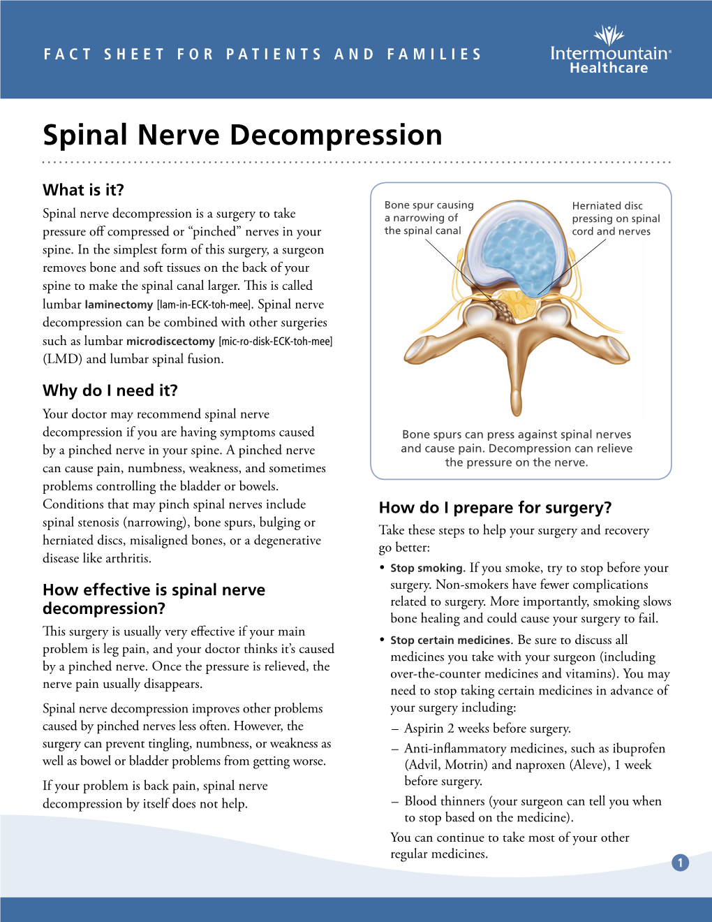 Spinal Nerve Decompression Fact Sheet