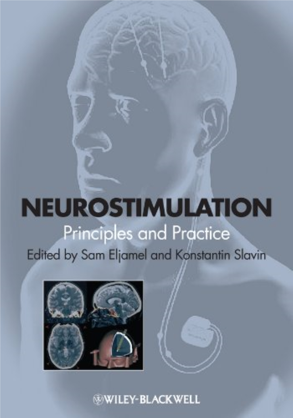 Deep Brain Stimulation 1 1 Deep Brain Stimulation: Mechanisms of Action 3 Erwin B