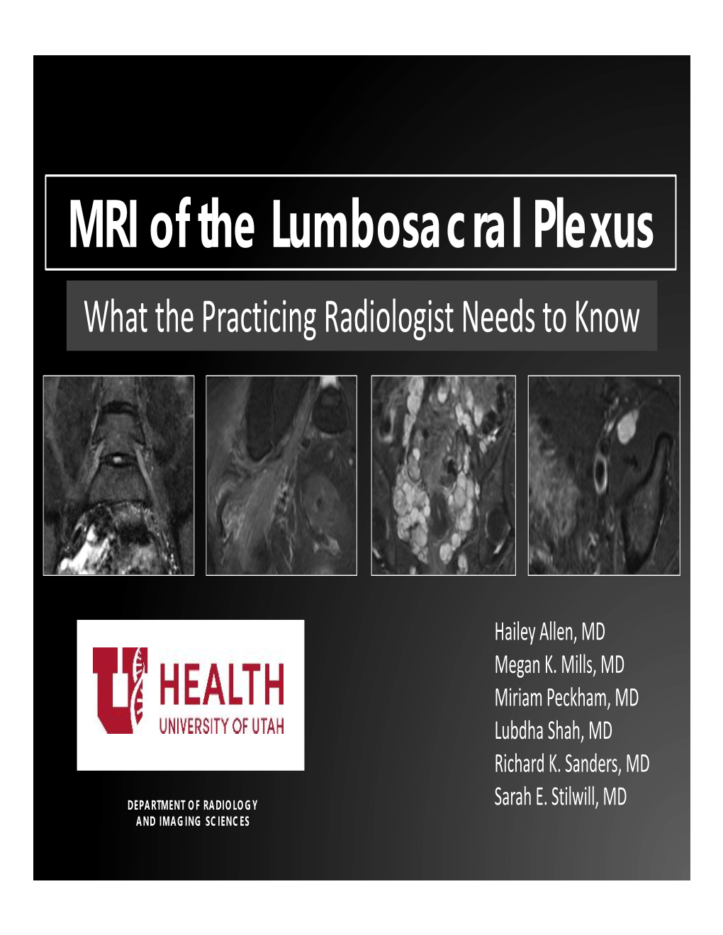 MRI of the Lumbosacral Plexus What the Practicing Radiologist Needs to Know