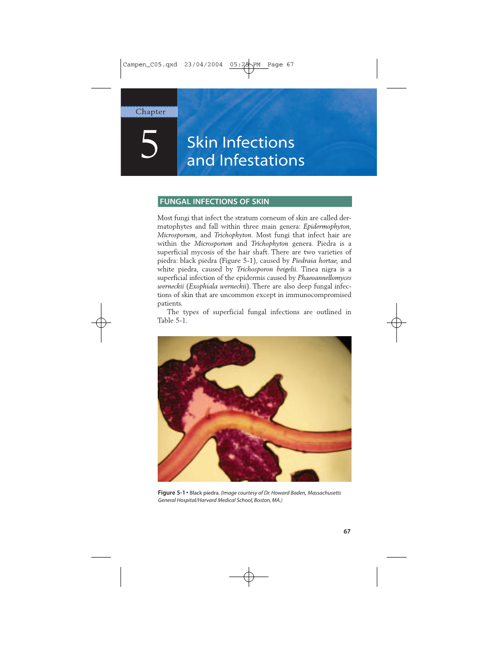 Skin Infections and Infestations • 67 Skin Infections 5 and Infestations