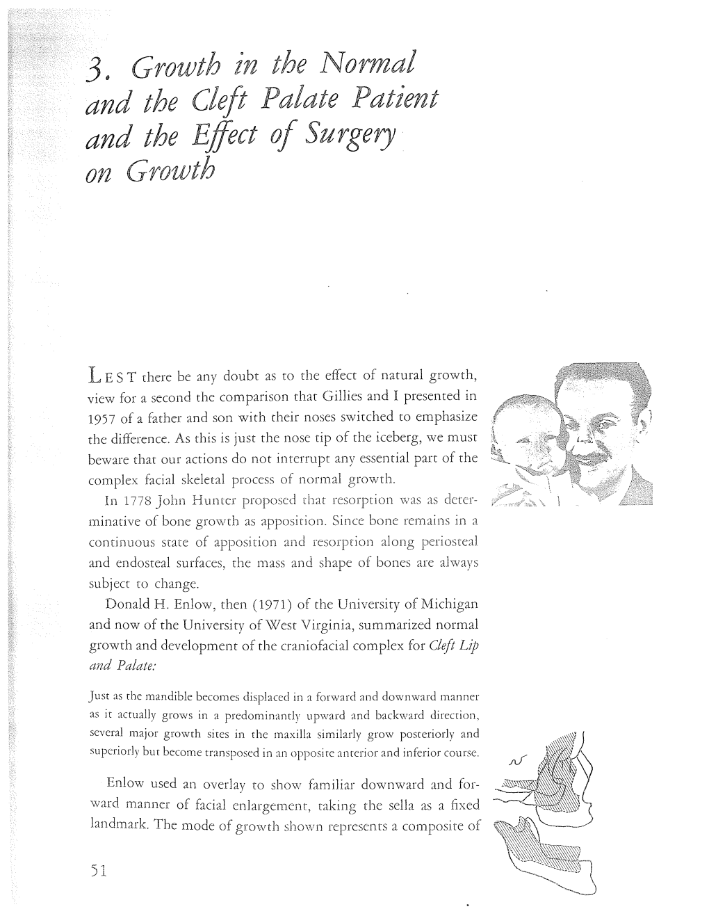 3. Growth in the Normal and the Cleft Palate Patient and the Effect Of