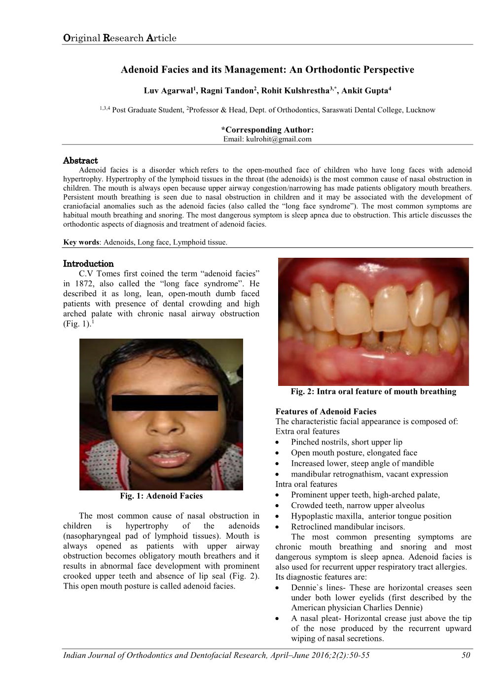 Adenoid Facies and Its Management: an Orthodontic Perspective