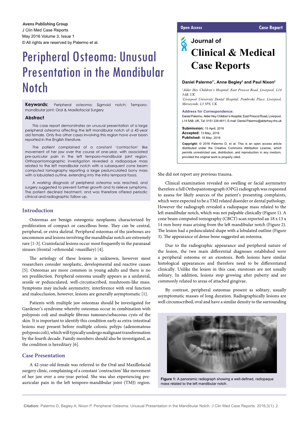 Peripheral Osteoma: Unusual Presentation in the Mandibular Notch